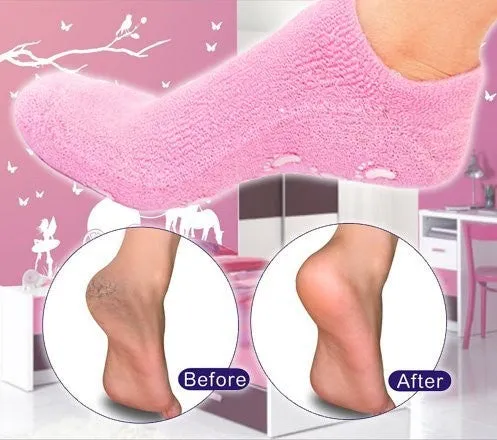 Importikaah Moisturize Skin Repair Cracked Moisturizing Treatment Gel Spa Socks – Pair